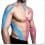 kinesio taping